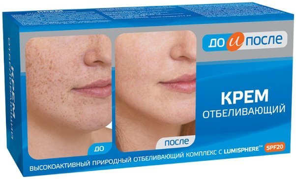 До и после Крем отбеливающий 100мл