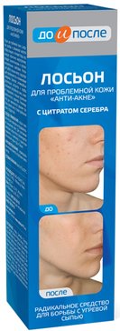 До и после Лосьон анти-акне для проблемной кожи 200мл