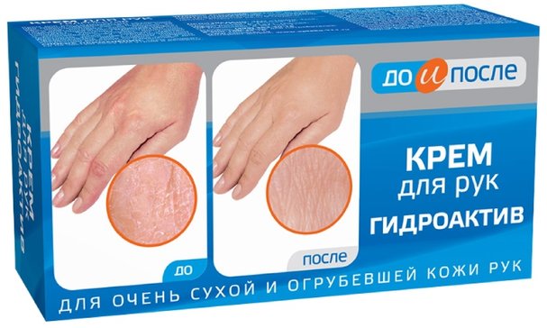 До и после Крем для рук гидроактив 100мл
