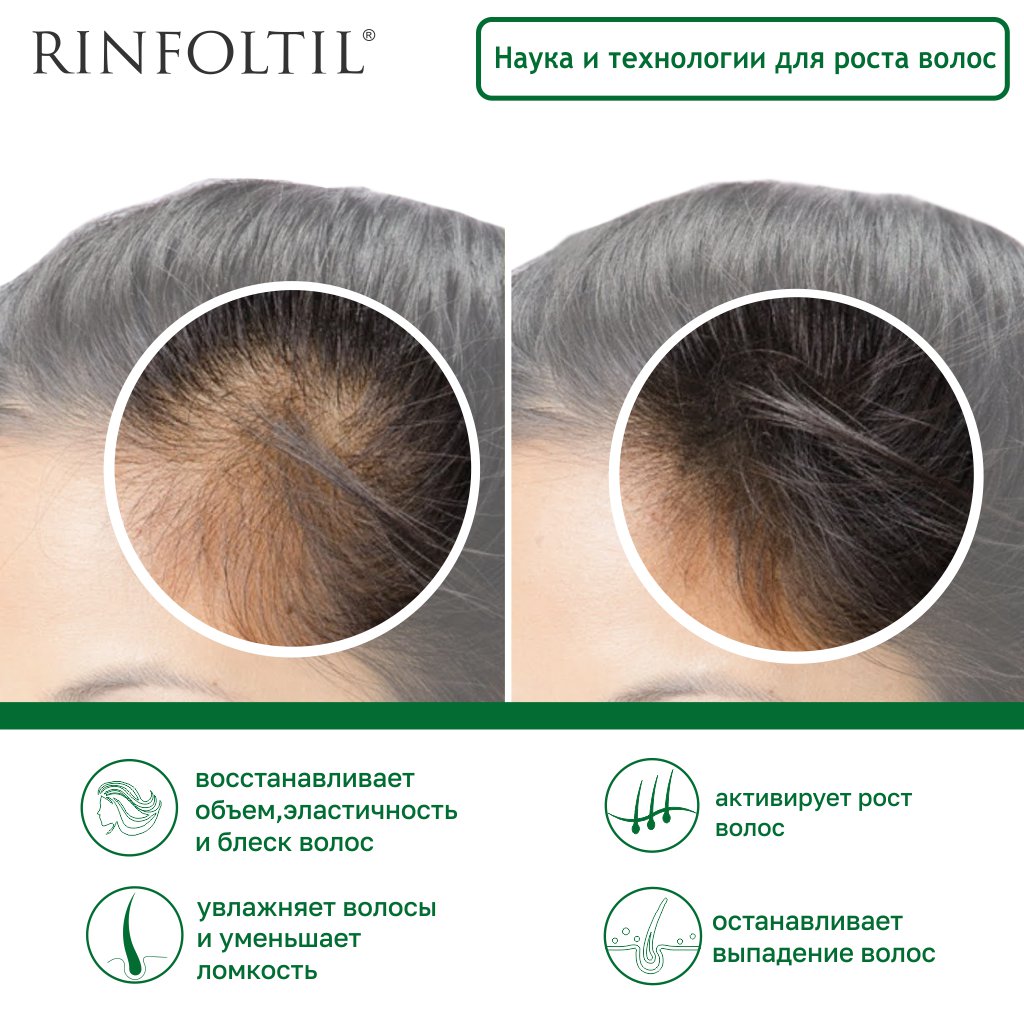 Ринфолтил сыворотка липосомальная против выпадения волос для интенсивного роста флакон 160мг N 30