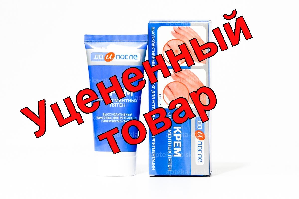 До и после Крем от пигментных пятен 50мл